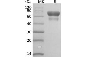 Western Blotting (WB) image for CD28 (CD28) (Active) protein (Biotin) (ABIN7319852) (CD28 Protein (CD28) (Biotin))
