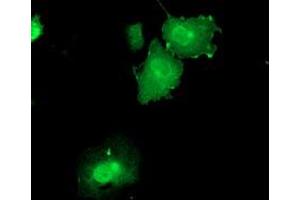 Anti-DUSP23 mouse monoclonal antibody (ABIN2455308) immunofluorescent staining of COS7 cells transiently transfected by pCMV6-ENTRY DUSP23 (RC200171). (DUSP23 Antikörper)