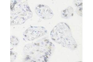 Immunohistochemistry of paraffin-embedded Human placenta using CREM Polyclonal Antibody at dilution of 1:100 (40x lens). (CREM Antikörper)