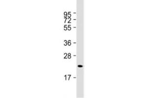 Western blot testing of human skeletal muscle lysate with Irisin antibody at 1:2000. (FNDC5 Antikörper  (AA 12-152))
