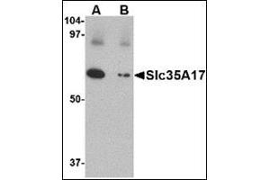 Western blot analysis of Slc22A17 in SK-N-SH lysate with this product at 1 μg/ml in (A) the absence and (B) the presence of blocking peptide. (SLC22A17 Antikörper  (C-Term))
