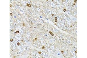Immunohistochemistry of paraffin-embedded Mouse brain using TPPP Polyclonal Antibody at dilution of 1:100 (40x lens). (Tppp Antikörper)