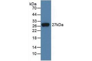 Detection of Recombinant FGF21, Human using Monoclonal Antibody to Fibroblast Growth Factor 21 (FGF21) (FGF21 Antikörper  (AA 29-209))