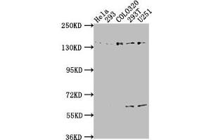 Western Blot Positive WB detected in: Hela whole cell lysate, 293 whole cell lysate, COLO320 whole cell lysate, 293T whole cell lysate, U251 whole cell lysate All lanes: ERC1 antibody at 1:2000 Secondary Goat polyclonal to rabbit IgG at 1/50000 dilution Predicted band size: 129, 114, 125, 109, 82 kDa Observed band size: 135 kDa (ERC1 Antikörper  (AA 1-224))