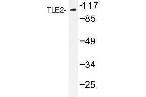 Image no. 1 for anti-Transducin-Like Enhancer Protein 2 (TLE2) antibody (ABIN272212) (TLE2 Antikörper)