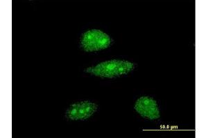 Immunofluorescence of monoclonal antibody to HEY1 on HeLa cell. (HEY1 Antikörper  (AA 121-220))