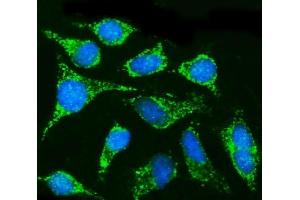 IF analysis of CPT1B using anti-CPT1B antibody (ABIN7600359). (CPT1B Antikörper  (AA 180-772))