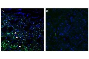 Expression of Frizzled-3 in mouse striatum. (FZD3 Antikörper  (Intracellular))