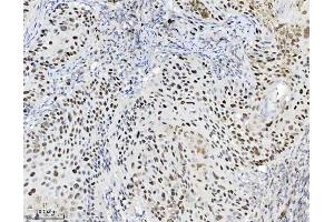 IHC analysis of MCM7 using anti-MCM7 antibody (ABIN7601968). (MCM7 Antikörper  (AA 526-719))