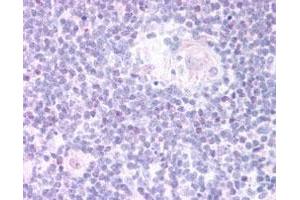 FOXN1 polyclonal antibody  staining (20 ug/mL) of paraffin embedded human thymus medulla. (FOXN1 Antikörper)