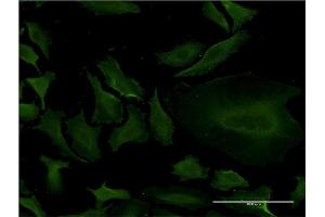 Immunofluorescence of monoclonal antibody to CYP1A2 on HeLa cell. (CYP1A2 Antikörper  (AA 211-310))