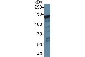 Western Blot; Sample: Human K562 cell lysate; Primary Ab: 1µg/ml Rabbit Anti-Rat XPC Antibody Second Ab: 0. (XPC Antikörper  (AA 734-933))