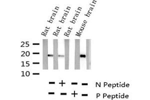 Western blot analysis of Phospho-Synuclein (Ser129) expression in various lysates (SNCA Antikörper  (pSer129))