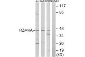 Western blot analysis of extracts from HuvEc/COS/Jurkat cells, using RIMKA Antibody. (RIMKLA Antikörper  (AA 112-161))