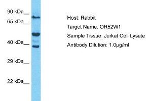 Host: Rabbit Target Name: OR52W1 Sample Type: Jurkat Whole Cell lysates Antibody Dilution: 1. (OR52W1 Antikörper  (C-Term))