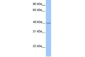 WB Suggested Anti-ZNF385D Antibody Titration:  0. (ZNF385D Antikörper  (N-Term))