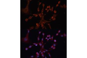 Immunofluorescence (IF) image for anti-Guanine Nucleotide Binding Protein (G Protein), alpha 14 (GNa14) (AA 40-350) antibody (ABIN6141196)