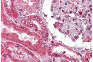 Human Kidney (formalin-fixed, paraffin-embedded) stained with Collagen I antibody ABIN462339 followed by biotinylated goat anti-rabbit IgG secondary antibody ABIN481713, alkaline phosphatase-streptavidin and chromogen. (Collagen Type I Antikörper)