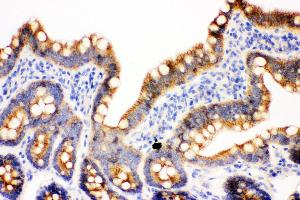 Anti- gamma Catenin Picoband antibody, IHC(P) IHC(P): Rat Intestine Tissue (JUP Antikörper  (AA 556-745))