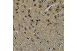 Immunohistochemistry of paraffin-embedded mouse brain using LGI1 antibody at dilution of 1:200 (400x lens).
