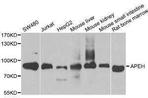 Western blot analysis of extracts of various cell lines, using APEH antibody. (APEH Antikörper)