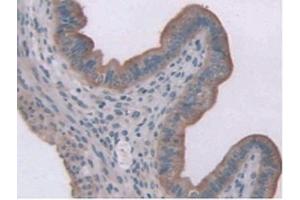 IHC-P analysis of Mouse Uterus Tissue, with DAB staining. (Leptin Receptor Antikörper  (AA 22-203))