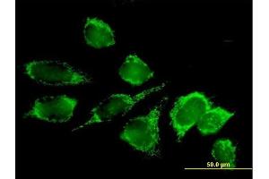 Immunofluorescence of purified MaxPab antibody to DLAT on HeLa cell. (DLAT Antikörper  (AA 1-647))