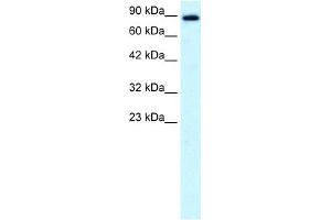 WB Suggested Anti-KIF21A Antibody Titration:  0. (KIF21A Antikörper  (N-Term))