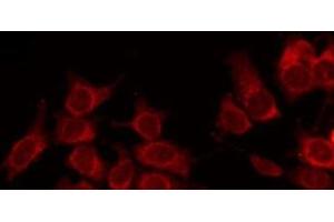 ABIN6266839 staining NIH-3T3 by IF/ICC. (alpha Tubulin Antikörper)