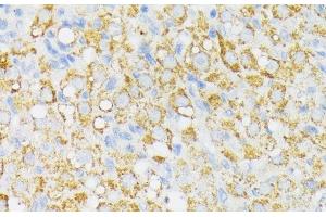 Immunohistochemistry (Paraffin-embedded Sections) (IHC (p)) image for anti-Ubiquitin Specific Peptidase 33 (USP33) antibody (ABIN7258976)