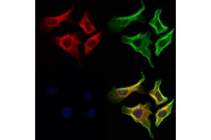 ABIN6263965 and ABIN6273063 staining Hela cells by IF/ICC.