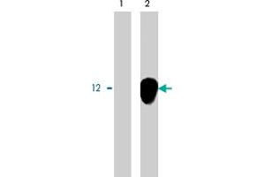 Immunoprecipitation using DAP12 polyclonal antibody on MHC class I (1) and NKp44 (2) positive cells. (TYROBP Antikörper)