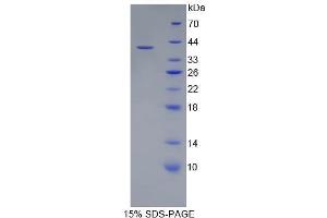 SDS-PAGE (SDS) image for Complement Component 5a (C5a) (AA 1-77) protein (His tag,GST tag) (ABIN1880001)