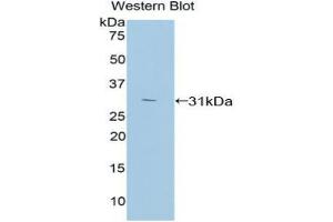 Western blot analysis of the recombinant protein. (PKC zeta Antikörper  (AA 254-484))