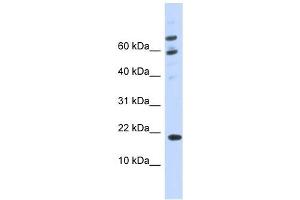 C21ORF87 antibody used at 1 ug/ml to detect target protein. (BRWD1-AS2 Antikörper)