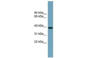 NUDCD3 antibody used at 1 ug/ml to detect target protein.