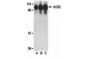 Western Blotting (WB) image for anti-Angiotensin I Converting Enzyme 2 (ACE2) (Middle Region 1) antibody (ABIN1031184) (ACE2 Antikörper  (Middle Region 1))