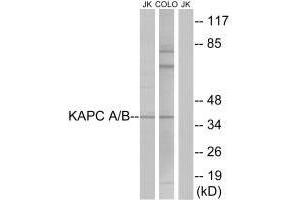 Western blot analysis of extracts from Jurkat cells and COLO cells, using KAPC A/B antibody. (PRKACA Antikörper  (N-Term))