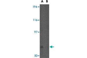 Western blot analysis of FNBP1L in human brain tissue lysate in (A) the absence and (B) the presence of blocking peptide with FNBP1L polyclonal antibody  at 0. (FNBP1L Antikörper  (N-Term))