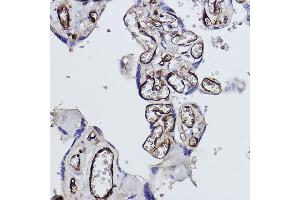 Immunohistochemistry of paraffin-embedded human placenta using Tryptophanyl-tRNA synthetase 1 Rabbit mAb (ABIN1678761, ABIN3018963, ABIN3018964 and ABIN7101695) at dilution of 1:100 (40x lens). (WARS Antikörper)