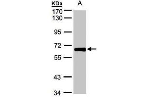 WB Image Sample(30 ug whole cell lysate) A:HeLa S3, 7. (ZNF169 Antikörper)