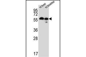 Western blot analysis of TMEM87B Antibody (C-term) (ABIN651478 and ABIN2840259) in mouse liver,bladder tissue lysates (35 μg/lane). (TMEM87B Antikörper  (C-Term))