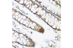 Immunohistochemistry of paraffin-embedded human colon using NCBP2 antibody (ABIN5974395) at dilution of 1/200 (40x lens). (NCBP2 Antikörper)