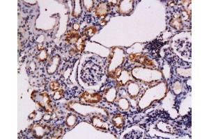 Formalin-fixed and paraffin embedded rat kidney tissue labeled Anti-CD117/c-kit/SCFR Polyclonal Antibody, Unconjugated  at 1:200, followed by conjugation to the secondary antibody and DAB staining (KIT Antikörper  (AA 901-976))