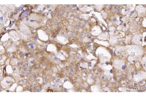 IHC analysis of ABP1/AOC1 using anti-ABP1/AOC1 antibody (ABIN4886460).