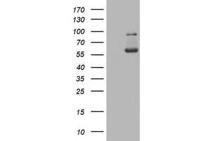 Western Blotting (WB) image for anti-PKM1 antibody (ABIN2729046) (PKM1 Antikörper)
