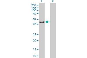Western Blot analysis of C13orf31 expression in transfected 293T cell line by C13orf31 MaxPab polyclonal antibody. (LACC1 Antikörper  (AA 1-430))