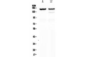 Western blot analysis of MYBPC3 using anti-MYBPC3 antibody . (MYBPC3 Antikörper  (AA 1070-1123))