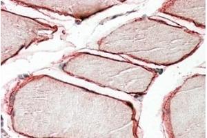 Image no. 1 for anti-Caveolin 3 (CAV3) (N-Term) antibody (ABIN375161) (Caveolin 3 Antikörper  (N-Term))