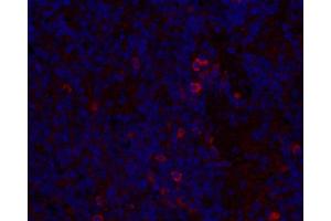 Immunofluorescence analysis of paraffin-embedded mouse inflammatory spleen using IL2 Polyclonal Antibody at dilution of 1:300. (IL-2 Antikörper)